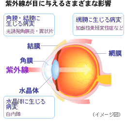 目の病気について